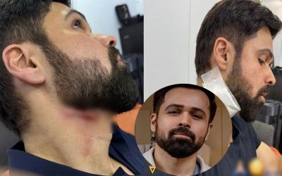 অল্পের জন্য বেঁচে গেলেন ইমরান হাসমি